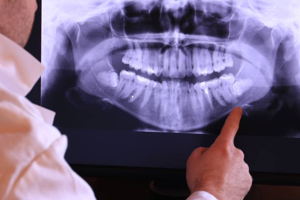 Best Cracked Tooth Emergency Dentist  in Coldstream, KY
